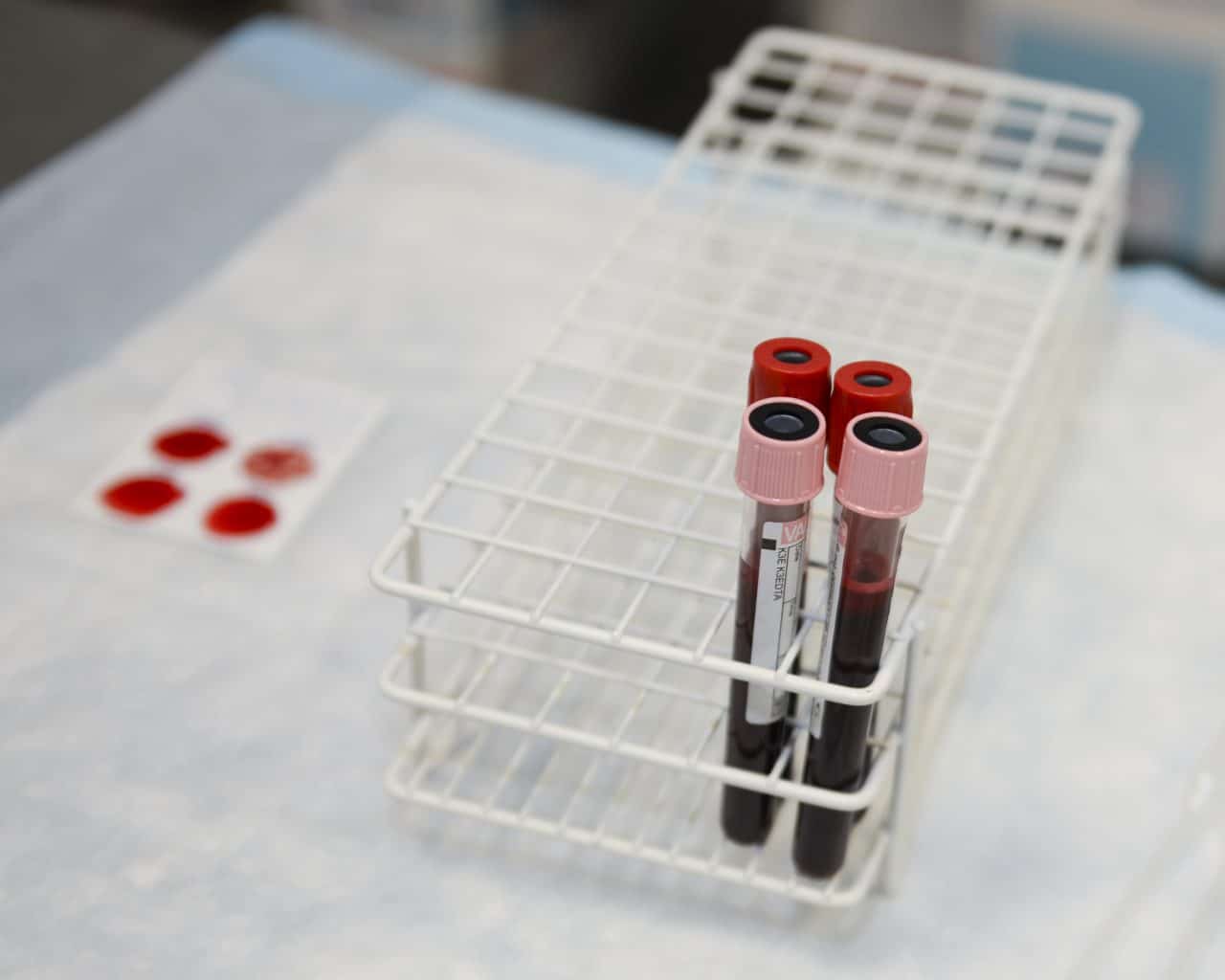 Test tubes of blood on a table